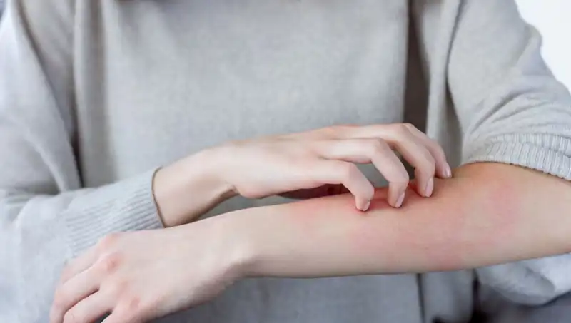 Cilt Kanseri Belirtilerine Dikkat! Dermatologdan Gözden Kaçan İpuçları